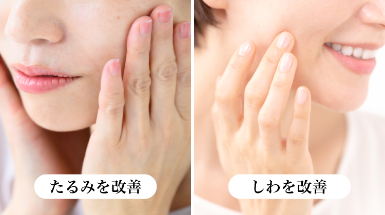 頬に手を当てる女性 ─ たるみ改善 頬を触れる女性 ─ しわ改善